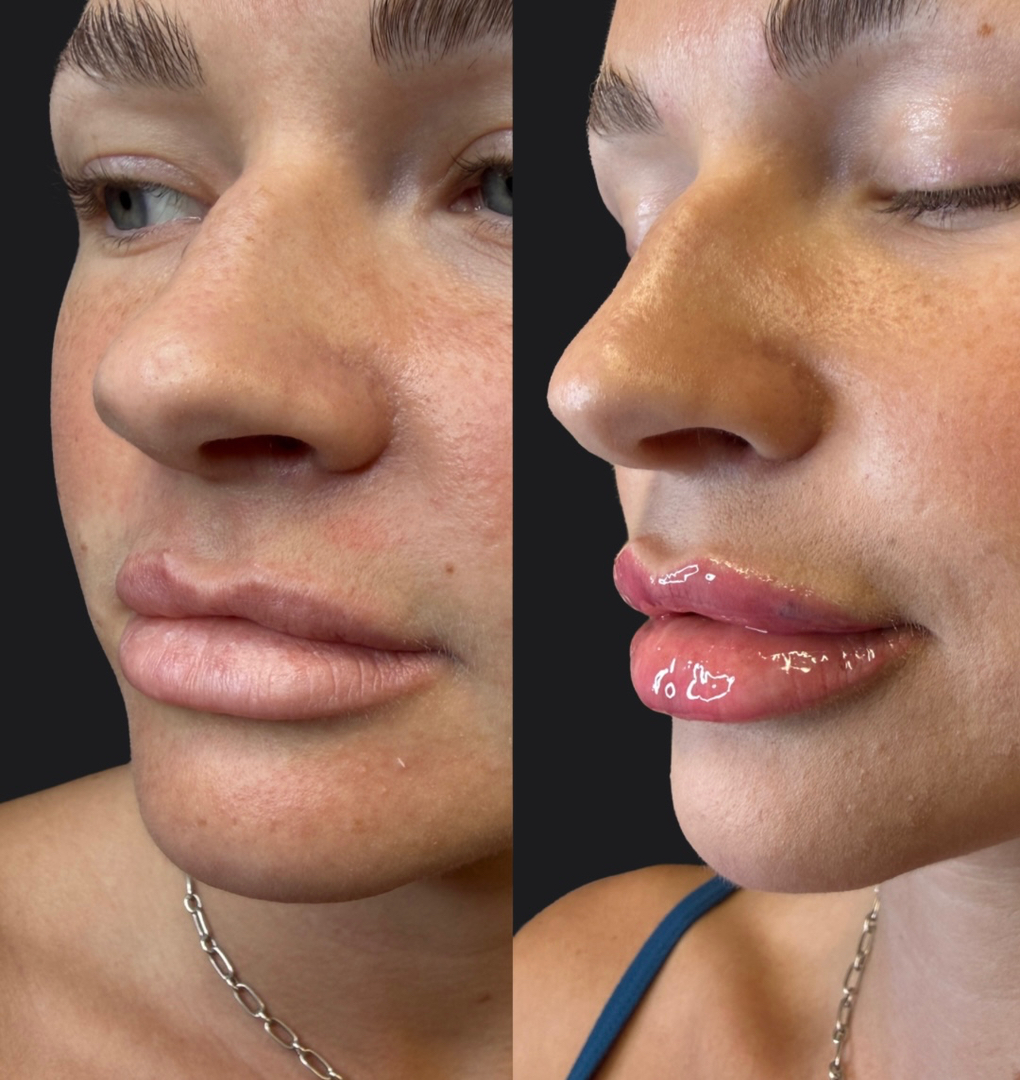 glutathione injections in gilbert az Revitalize with Glutathione: Unveiling the Energy Luxury Medical Aesthetics & Wellness